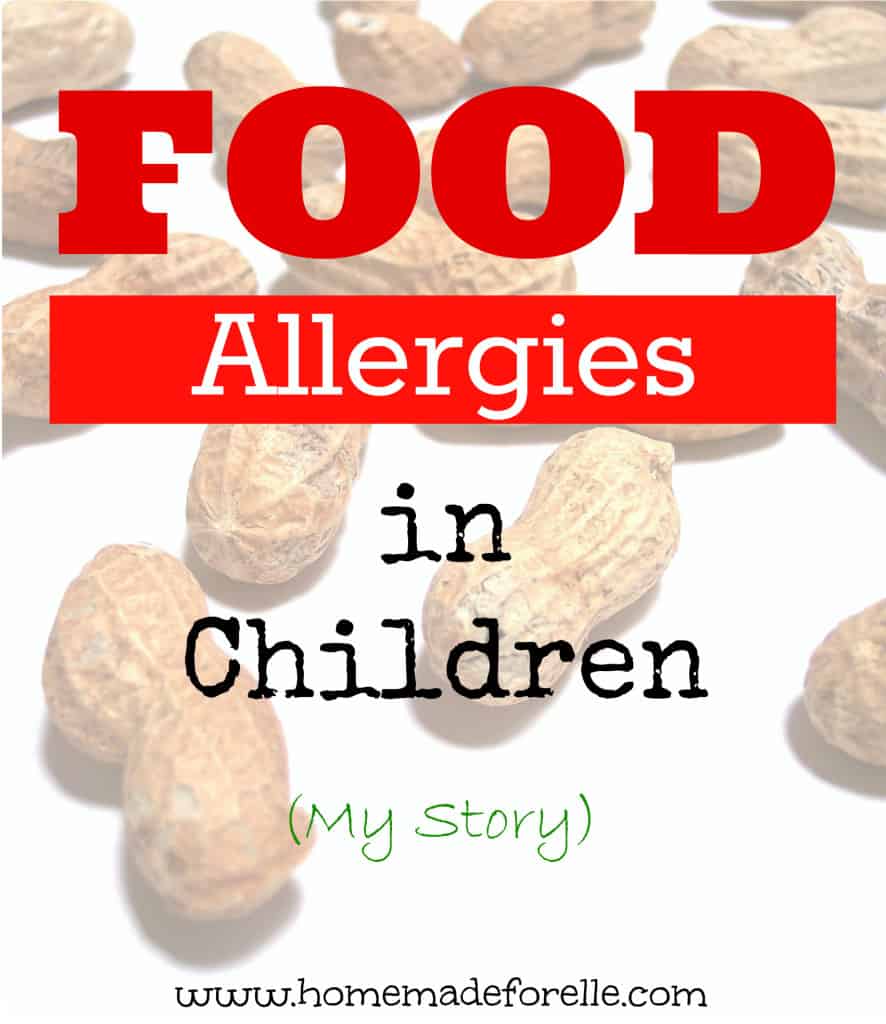 Food Allergies in Children – My Story