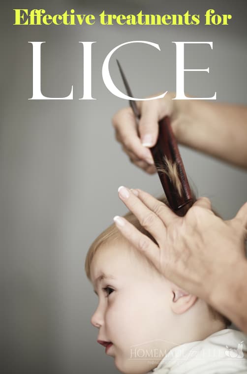 effective treatments for lice
