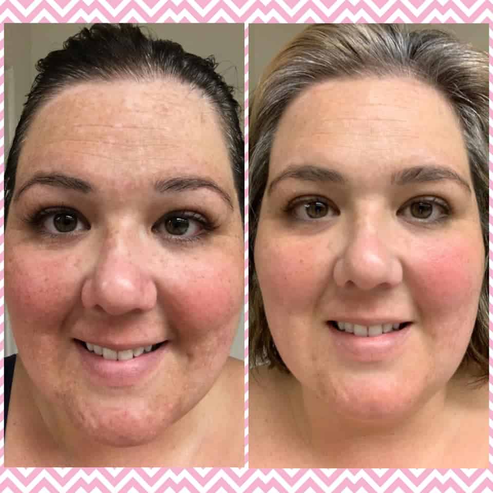 BeautyCounter Overnight Resurfacing Peel Before and After Picture